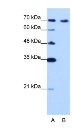 CARF/CDKN2AIP Antibody, Novus Biologicals 0.1mg; Unlabeled:Antibodies,