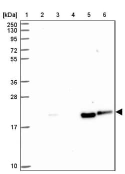 CARHSP1 Antibody, Novus Biologicals 0.1 mL | Buy Online | Novus Biologicals | Fisher Scientific