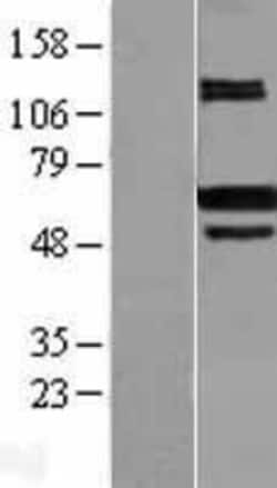 Novus Biologicals&trade;&nbsp;Carm1 Overexpression Lysate