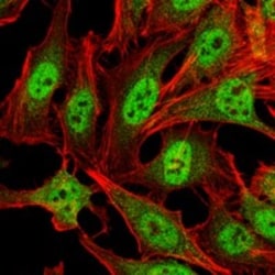 Carm1 Antibody (3H2), Novus Biologicals:Antibodies:Primary Antibodies