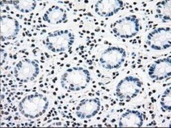 Carnosine Dipeptidase 1/CNDP1 Antibody (OTI2F8), Novus Biologicals 0.1mL;