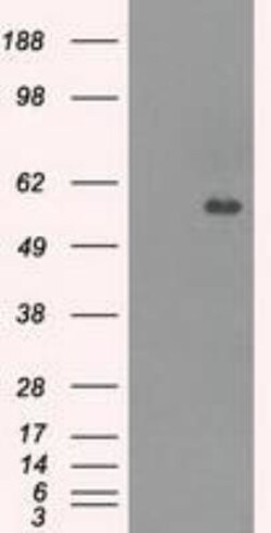 Carnosine Dipeptidase 1/CNDP1 Antibody (OTI2F8), Novus Biologicals 0.1mL;