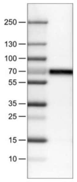Carnosine Dipeptidase 1/CNDP1 Antibody (CL0339), Novus Biologicals 25 &mu;L,