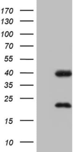 CAR/NR1I3 Antibody (OTI1C6), Novus Biologicals 0.1 mL | Buy Online | Novus Biologicals | Fisher Scientific