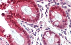 CAR/NR1I3 Antibody, Novus Biologicals 0.05mg; Unlabeled:Antibodies, Polyclonal