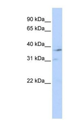 CAR/NR1I3 Antibody, Novus Biologicals 0.05mg; Unlabeled:Antibodies, Polyclonal
