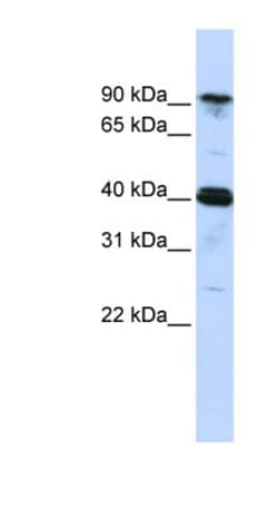 CARS Antibody, Novus Biologicals 100μL; Unlabeled:Antibodies, Polyclonal