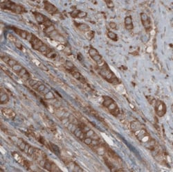 CARS Antibody (CL2302), Novus Biologicals:Antibodies:Primary Antibodies