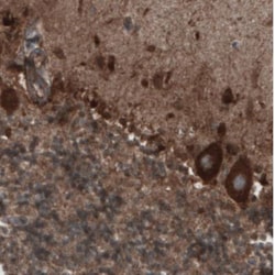 CARS Antibody (CL2302), Novus Biologicals:Antibodies:Primary Antibodies