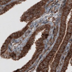 CARS Antibody (CL2302), Novus Biologicals:Antibodies:Primary Antibodies