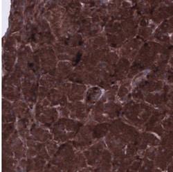 CARS Antibody (CL2302), Novus Biologicals:Antibodies:Primary Antibodies
