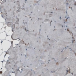 CARS Antibody (CL2302), Novus Biologicals:Antibodies:Primary Antibodies
