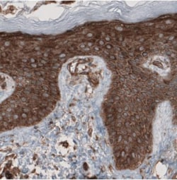 CARS Antibody (CL2304), Novus Biologicals 25 &mu;L, Unlabeled:Antibodies,