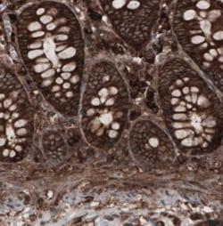 CARS Antibody (CL2304), Novus Biologicals 25 &mu;L, Unlabeled:Antibodies,