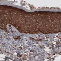 CARS Antibody (CL2309), Novus Biologicals 25 &mu;L, Unlabeled:Antibodies,