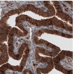 CARS Antibody (CL2309), Novus Biologicals 25 &mu;L, Unlabeled:Antibodies,