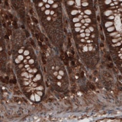 CARS Antibody (CL2309), Novus Biologicals 25 &mu;L, Unlabeled:Antibodies,