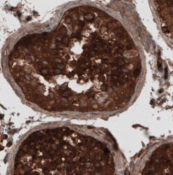CARS Antibody (CL2309), Novus Biologicals 25 &mu;L, Unlabeled:Antibodies,