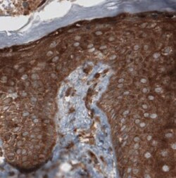 CARS Antibody (CL2310), Novus Biologicals 0.1 mL | Buy Online | Novus Biologicals | Fisher Scientific