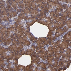 CARS Antibody, Novus Biologicals 25 &mu;L; Unlabeled:Antibodies, Polyclonal