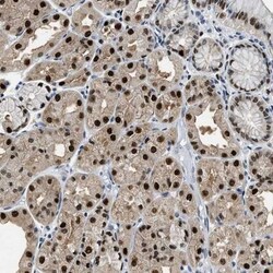 CART1 Antibody, Novus Biologicals 0.1mL; Unlabeled:Antibodies, Polyclonal