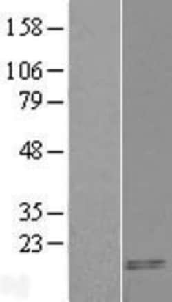 Novus Biologicals&trade;&nbsp;CART/CARTPT Overexpression Lysate
