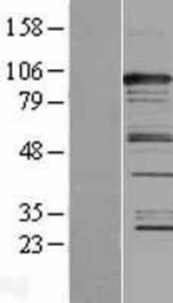 Novus Biologicals&trade;&nbsp;CASC3 Overexpression Lysate