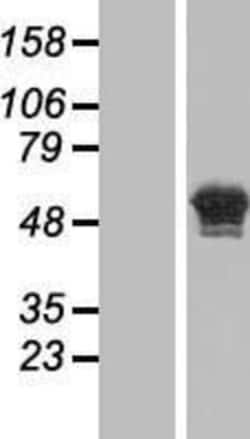Novus Biologicals&trade;&nbsp;CASC4 Overexpression Lysate