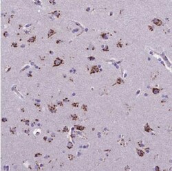 CASC4 Antibody, Novus Biologicals:Antibodies:Primary Antibodies