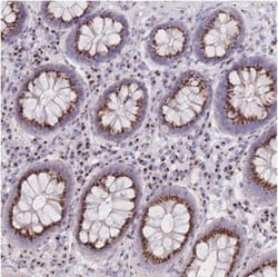 CASC4 Antibody, Novus Biologicals 0.1 mL | Buy Online | Novus Biologicals | Fisher Scientific