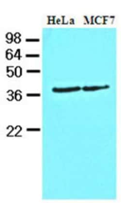 Casein Kinase 1 alpha Antibody (2E2) - BSA Free, Novus Biologicals 0.1mL;