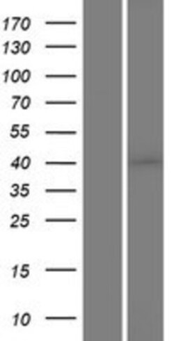 Novus Biologicals&trade;&nbsp;Casein Kinase 1 alpha Overexpression Lysate