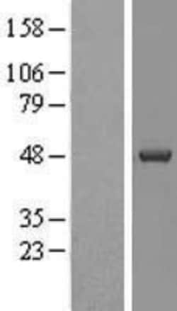 Novus Biologicals&trade;&nbsp;Casein Kinase 1 delta Overexpression Lysate
