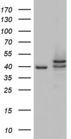 Casein Kinase 1 epsilon Antibody (OTI5D4), Novus Biologicals 0.1mL; Unlabeled:Antibodies,