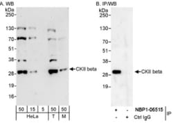 Casein Kinase 2 beta Antibody, Novus Biologicals 0.1mL; Unlabeled:Antibodies,