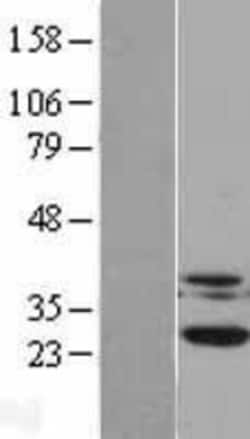 Novus Biologicals&trade;&nbsp;Casein Kinase 2 beta Overexpression Lysate