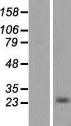 Novus Biologicals&trade;&nbsp;Casein Overexpression Lysate