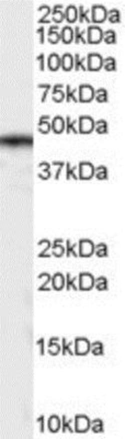 Casein Kinase 1 delta Antibody, Novus Biologicals 0.1mg; Unlabeled:Antibodies,