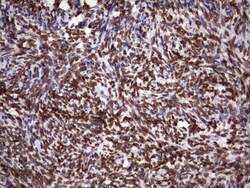 Casein Kinase 1 epsilon Antibody (OTI5D4), Novus Biologicals 0.1mL; Unlabeled:Antibodies,