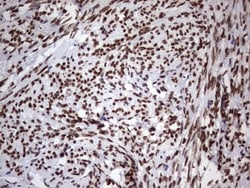 Casein Kinase 1 epsilon Antibody (OTI5D4), Novus Biologicals 0.1mL; Unlabeled:Antibodies,