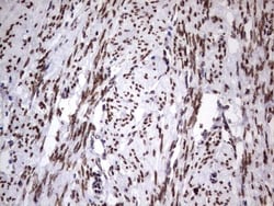 Casein Kinase 1 epsilon Antibody (OTI5D4), Novus Biologicals 0.1mL; Unlabeled:Antibodies,