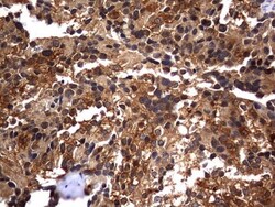 Casein Kinase 1 gamma 2 Antibody (OTI4H3), Novus Biologicals 0.1mL; Unlabeled:Antibodies,
