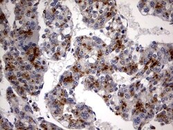 Casein Kinase 1 gamma 2 Antibody (OTI4H3), Novus Biologicals 0.1mL; Unlabeled:Antibodies,