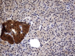 Casein Kinase 1 gamma 2 Antibody (OTI4H3), Novus Biologicals 0.1mL; Unlabeled:Antibodies,