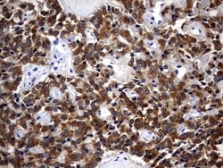Casein Kinase 1 gamma 2 Antibody (OTI4H3), Novus Biologicals 0.1mL; Unlabeled:Antibodies,