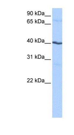 Casein Kinase 1 gamma 2 Antibody, Novus Biologicals 100 &mu;L | Buy Online | Novus Biologicals | Fisher Scientific