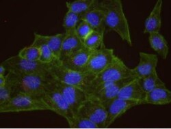 Casein Kinase 2 beta Antibody, Novus Biologicals 0.1mL; Unlabeled:Antibodies,