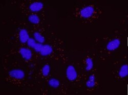 Casein Kinase 2 beta Antibody, Novus Biologicals 0.1mL; Unlabeled:Antibodies,