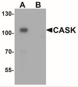 CASK Antibody - BSA Free, Novus Biologicals:Antibodies:Primary Antibodies