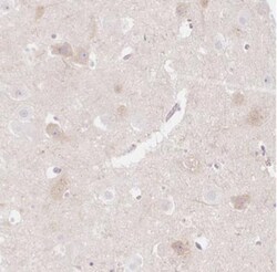 CASK Interacting Protein 1 Antibody, Novus Biologicals 0.1mL; Unlabeled:Antibodies,